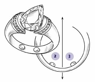 Arthritic Knuckle and Top Heavy Ring Solutions